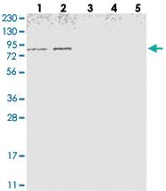 Anti-NOL11 Rabbit Polyclonal Antibody