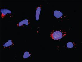 Anti-FASLG + PIK3R1 Antibody Pair