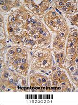 Anti-AKR1A1 Rabbit Polyclonal Antibody