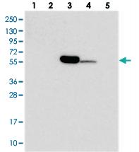 Anti-C11ORF80 Rabbit Polyclonal Antibody