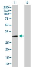 Anti-PPP1R1B Mouse Polyclonal Antibody