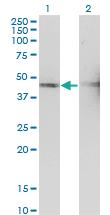 Anti-TSSC1 Mouse Monoclonal Antibody [clone: 2H5]