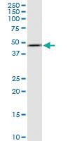 Anti-FBXO28 Polyclonal Antibody Pair