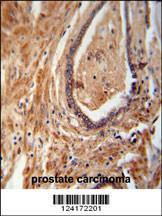 Anti-NDUFAF1 Rabbit Polyclonal Antibody (HRP (Horseradish Peroxidase))