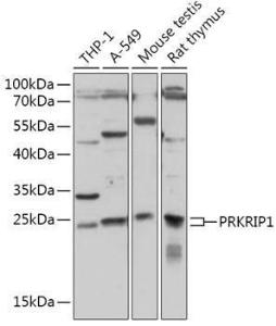 Western blot analysis of extracts of various cell lines, using Anti-PRKRIP1 Antibody (A309086) at 1:1,000 dilution. The secondary antibody was Goat Anti-Rabbit IgG H&L Antibody (HRP) at 1:10,000 dilution.