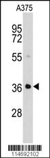 Anti-AKR1B1 Rabbit Polyclonal Antibody