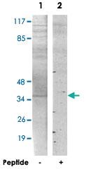 Anti-PMEPA1 Rabbit Polyclonal Antibody