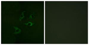 Immunofluorescence analysis of A549 cells using Anti-CBL Antibody. The right hand panel represents a negative control, where the antibody was pre-incubated with the immunising peptide.