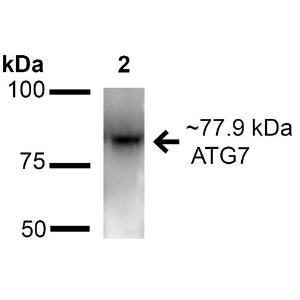 Western blot analysis of mouse and rat brain cell lysates showing detection of ~77.9 kDa ATG7 protein using Anti-ATG7 Antibody (A305057) at 1:1,000 for 16 hours at 4 °C