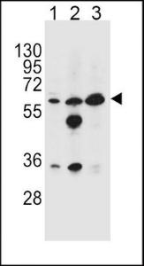 Anti-GATM Rabbit Polyclonal Antibody (APC (Allophycocyanin))