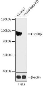 Western blot analysis of extracts from normal (control) and HSP90AB1 knockout (KO) HeLa cells, using Anti-Hsp90 beta Antibody (A93016) at 1:1000 dilution. The secondary Antibody was Goat Anti-Rabbit IgG H&L Antibody (HRP) at 1:10000 dilution