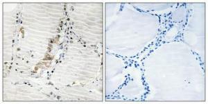 Immunohistochemical analysis of paraffin-embedded human thyroid gland using Anti-ATPG Antibody 1:100 (4°C overnight) The right hand panel represents a negative control, where the antibody was pre-incubated with the immunising peptide