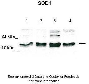 Anti-SOD1 Rabbit Polyclonal Antibody