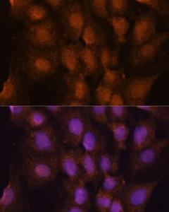 Immunofluorescence analysis of C6 cells using Anti-PRKRIP1 Antibody (A309086) at a dilution of 1:100. DAPI was used to stain the cell nuclei (blue).