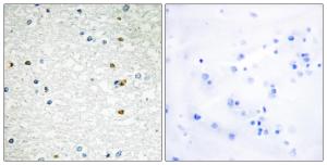 Immunohistochemical analysis of paraffin-embedded human brain using Anti-PARP3 Antibody. The right hand panel represents a negative control, where the antibody was pre-incubated with the immunising peptide