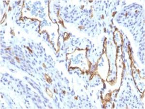 Anti-CD31 antibody