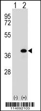 Anti-AKR1B1 Rabbit Polyclonal Antibody