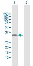 Anti-MLF1 Rabbit Polyclonal Antibody