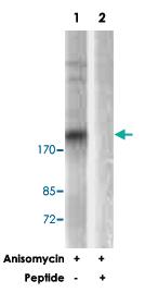 Anti-TSC2 Rabbit Polyclonal Antibody