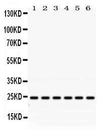 Anti-Rab5 Rabbit Polyclonal Antibody