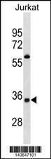 Anti-OR52A5 Rabbit Polyclonal Antibody (AP (Alkaline Phosphatase))