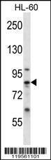 Anti-CAPN6 Rabbit Polyclonal Antibody (APC (Allophycocyanin))