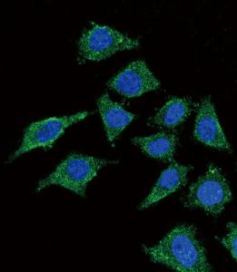 Anti-LCAT Rabbit Polyclonal Antibody (HRP (Horseradish Peroxidase))