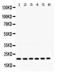 Anti-RAB10 Rabbit Polyclonal Antibody