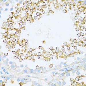 Anti-Dishevelled / Dvl1 Rabbit Polyclonal Antibody