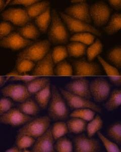 Immunofluorescence analysis of HeLa cells using Anti-PRKRIP1 Antibody (A309086) at a dilution of 1:100. DAPI was used to stain the cell nuclei (blue).