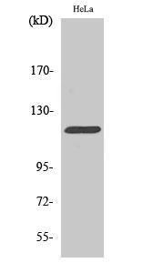 Western blot analysis of HeLa cells using Anti-CBL Antibody