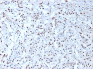 Anti-Wilms Tumor Protein Mouse Monoclonal Antibody [clone: WT1/857]