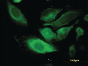 Anti-TSSC1 Mouse Monoclonal Antibody [clone: 2H5]