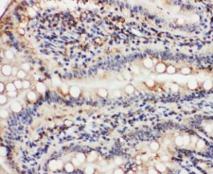 Anti-VCP Rabbit Polyclonal Antibody