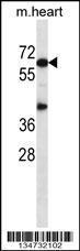 Anti-AKT1 Rabbit Polyclonal Antibody (Biotin)