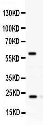 Anti-Rab11A Rabbit Polyclonal Antibody