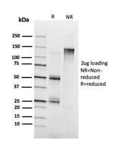 SDS-PAGE analysis of Anti-Annexin A1 Antibody [ANXA1/3728] under non-reduced and reduced conditions; showing intact IgG and intact heavy and light chains, respectively. SDS-PAGE analysis confirms the integrity and purity of the antibody