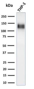 Anti-CD31 antibody