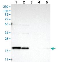 Anti-TIMM17B Rabbit Polyclonal Antibody