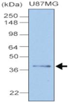 Anti-CLU Mouse Monoclonal Antibody [clone: 1A11]