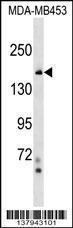 Anti-TONSL Rabbit Polyclonal Antibody (PE (Phycoerythrin))