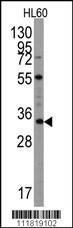 Anti-UBTD1 Rabbit Polyclonal Antibody (PE (Phycoerythrin))