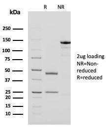 SDS-PAGE analysis of Anti-PAPP A Antibody [PAPPA/2718] under non-reduced and reduced conditions; showing intact IgG and intact heavy and light chains, respectively. SDS-PAGE analysis confirms the integrity and purity of the antibody.