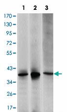 Anti-MAP2K6 Mouse Monoclonal Antibody [clone: 3H12C8]