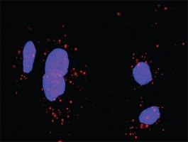 Anti-FGFR1 + CDH1 Antibody Pair