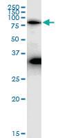 Anti-TAB2 Rabbit Polyclonal Antibody