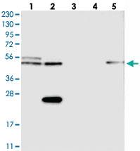 Anti-CDR2L Rabbit Polyclonal Antibody