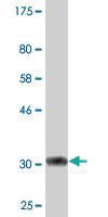 Anti-PSCA Mouse Monoclonal Antibody [clone: 1E1]