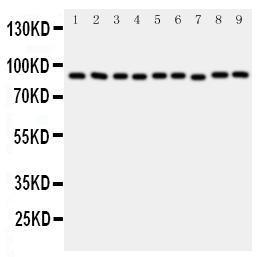 Anti-VCP Rabbit Polyclonal Antibody