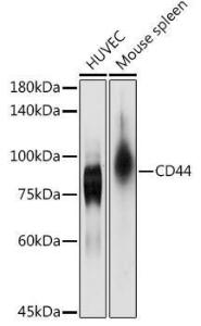 Western blot analysis of extracts of various cell lines, using Anti-CD44 Antibody (A93018) at 1:1,000 dilution The secondary antibody was Goat Anti-Rabbit IgG H&L Antibody (HRP) at 1:10,000 dilution Lysates/proteins were present at 25 µg per lane